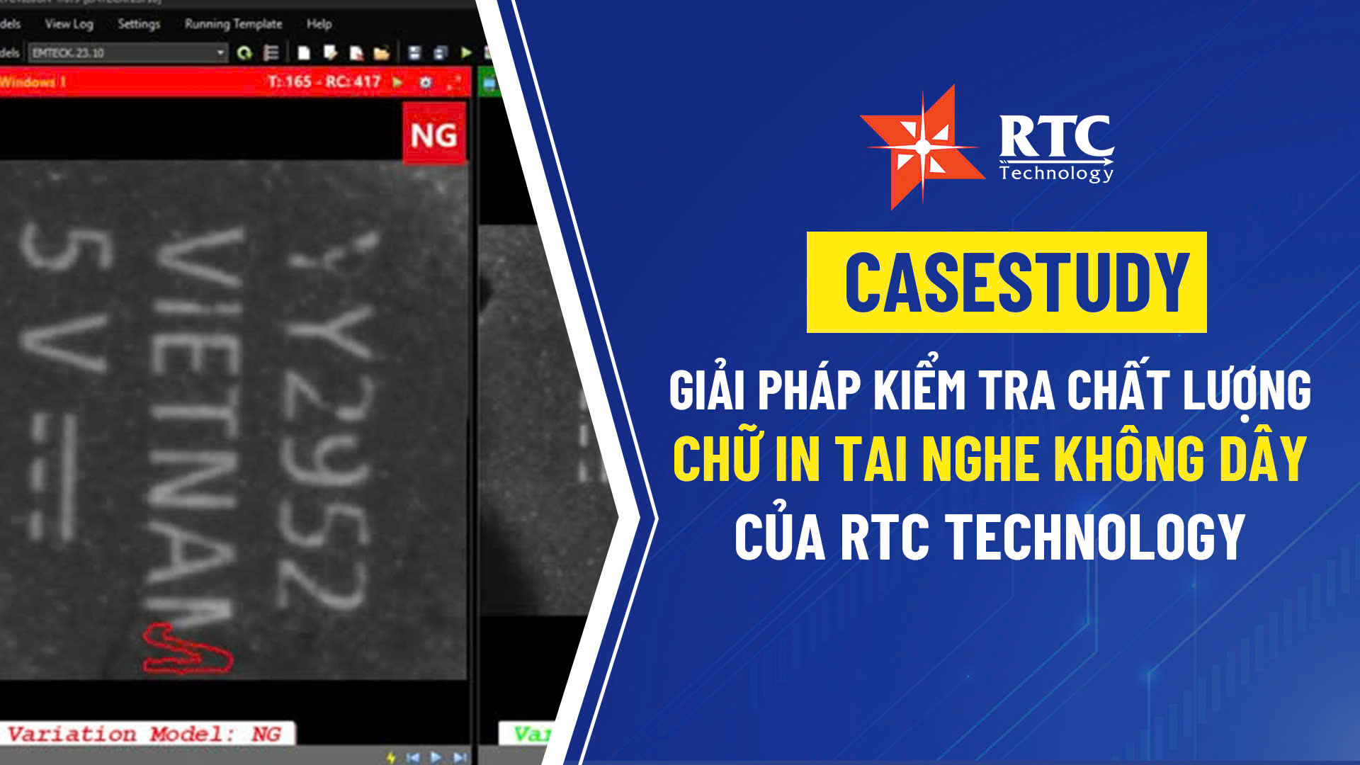 Case Study – Giải pháp kiểm tra chất lượng chữ in tai nghe không dây